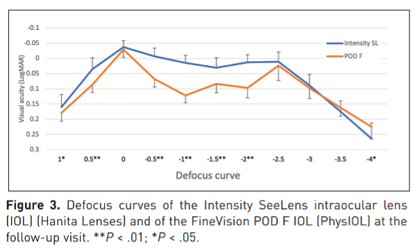 The Intensity IOL’s Flatter Defocus Curve